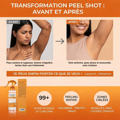 Peel Shot – Peau Douce & Teint Uniforme | Exfoliant Coréen