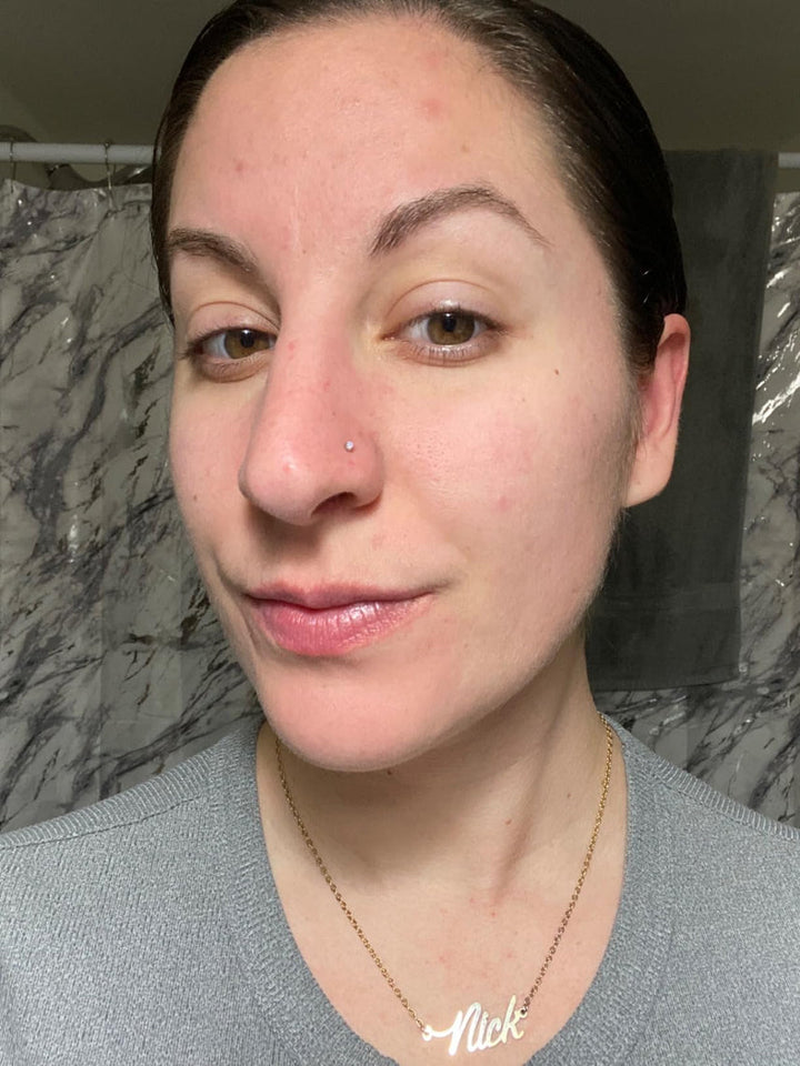 Thérèse, 34 ans
