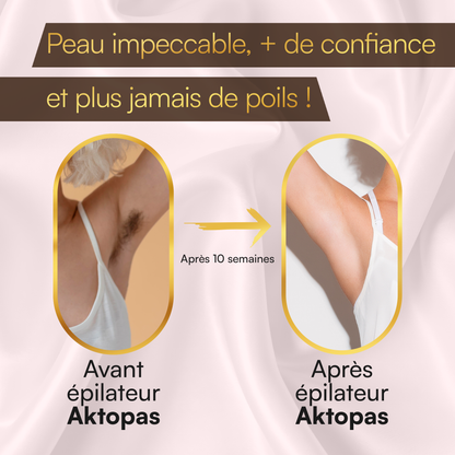 Épilateur IPL Aktopas - L'épilation laser à la maison