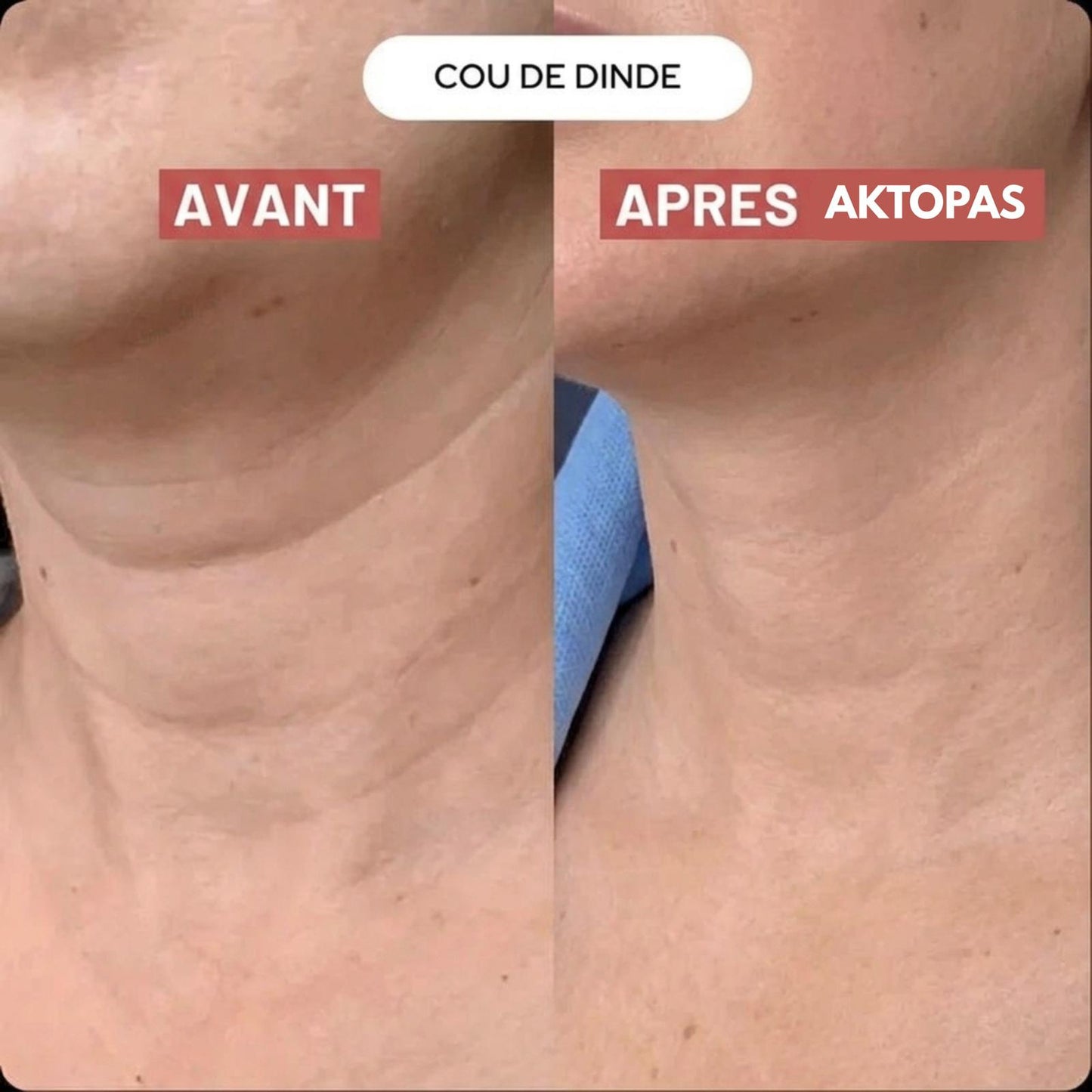 Lot de 5 masques pour le cou Aktopas™