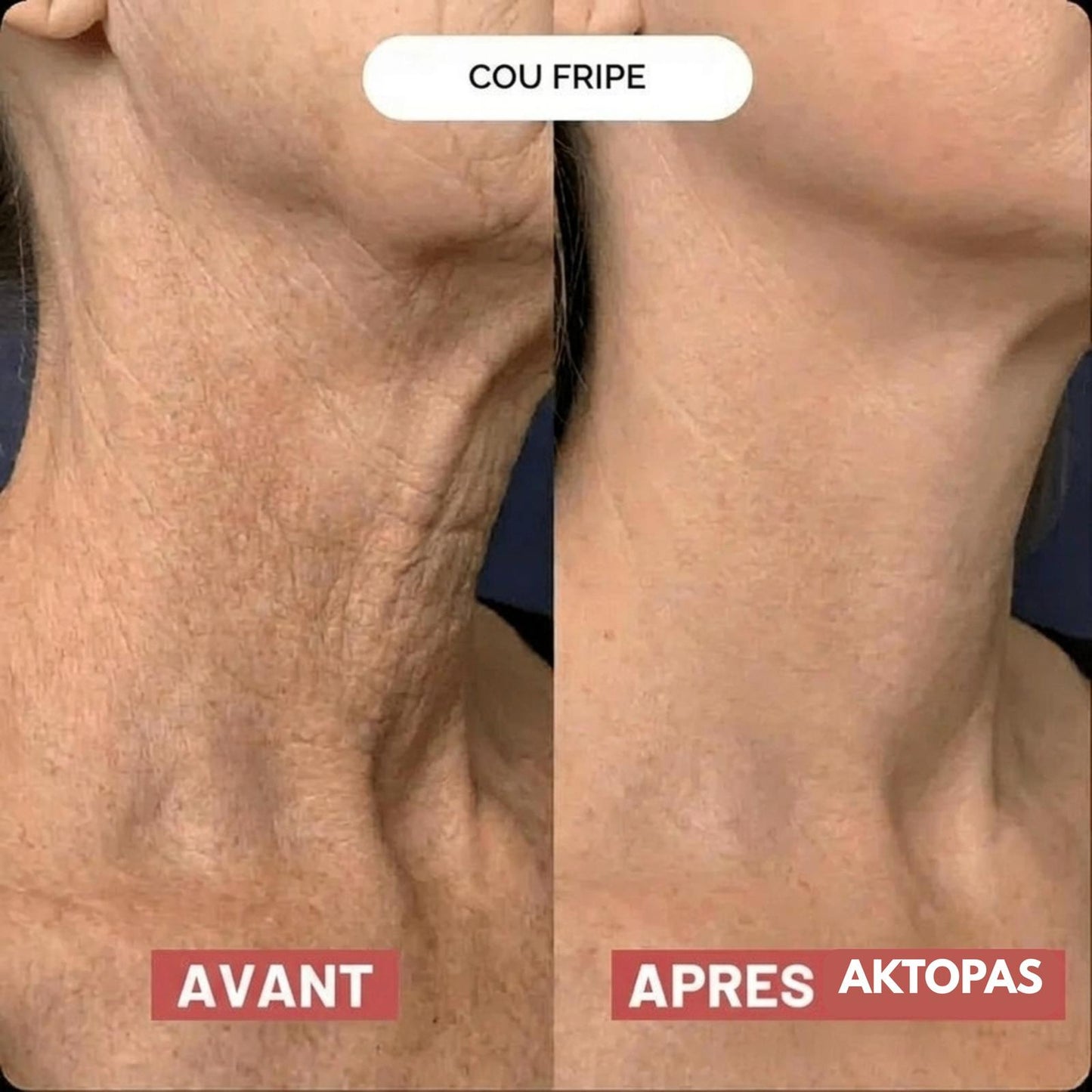 Lot de 5 masques pour le cou Aktopas™