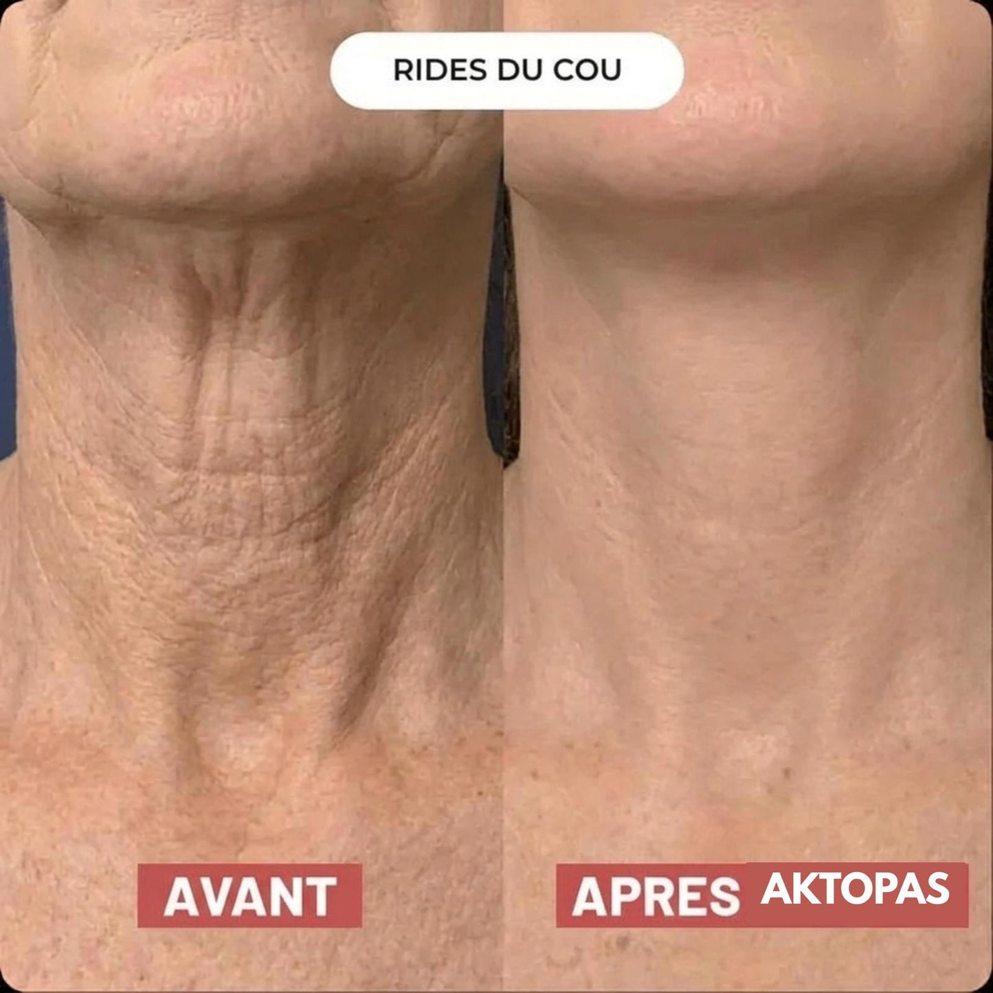 Lot de 5 masques pour le cou Aktopas™